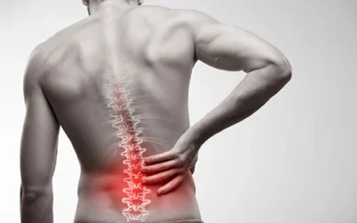 low-back-pain